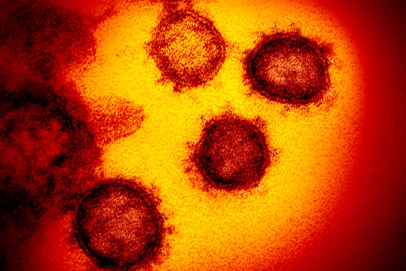 WHO experts say the coronavirus may never be defeated. (Photo: NIAID-RML via AP)