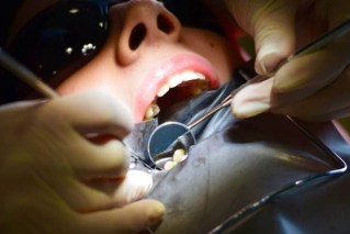 Why are so many Aussies raiding their super to pay for dental work?