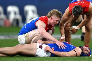 And the big men fly: Why AFL is under the pump to better manage concussions